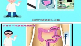 肛肠3科制作肠镜检查宣教视频
