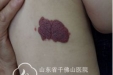 小小溶药包  浓浓关爱情