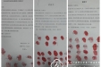 关键时刻敢“亮剑”——重症医学科抗疫纪实