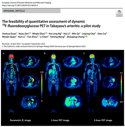核医学科程召平段艳华团队在国际著名学术期刊EJNMMI发表大动脉炎PET/CT动态参数成像研究成果