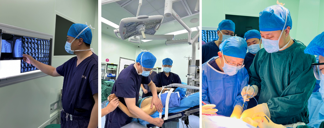 医院骨外科运动医学科开展省内首例Delta Xtend进口反式肩关节置换术