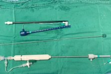 跳动心脏上的微创手术 我院完成院内首例经心尖二尖瓣钳夹成形术(ValveClamp技术)