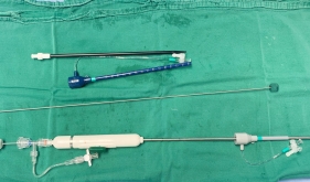 跳动心脏上的微创手术 我院完成院内首例经心尖二尖瓣钳夹成形术(ValveClamp技术)