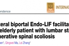 骨外科-脊柱外科再次在《国际外科学》杂志发表文章