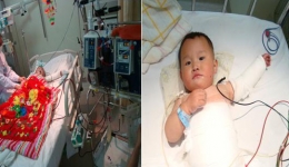 我院重症医学科（ICU）率先在省内成功开展幼儿血液净