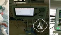 新年新气象 新生儿科运用新技术再创佳绩