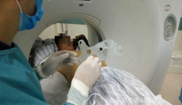 肿瘤微创科碘-125放射粒子植入手术首次采用3D打印非共平面模板引导技术