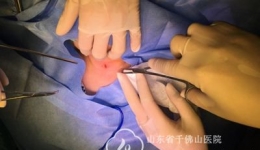 多学科联合 护佑院内首例气切造口早产儿健康成长