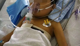 捐肝救女 7岁女孩接受肝移植再获新生