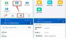 护理部静脉血栓质控在行动