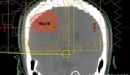 肿瘤放疗科直线加速器系统升级 实现精确定位精准施照