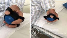 防拔管握力器应用临床受好评