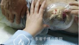 创新 一切为了患者