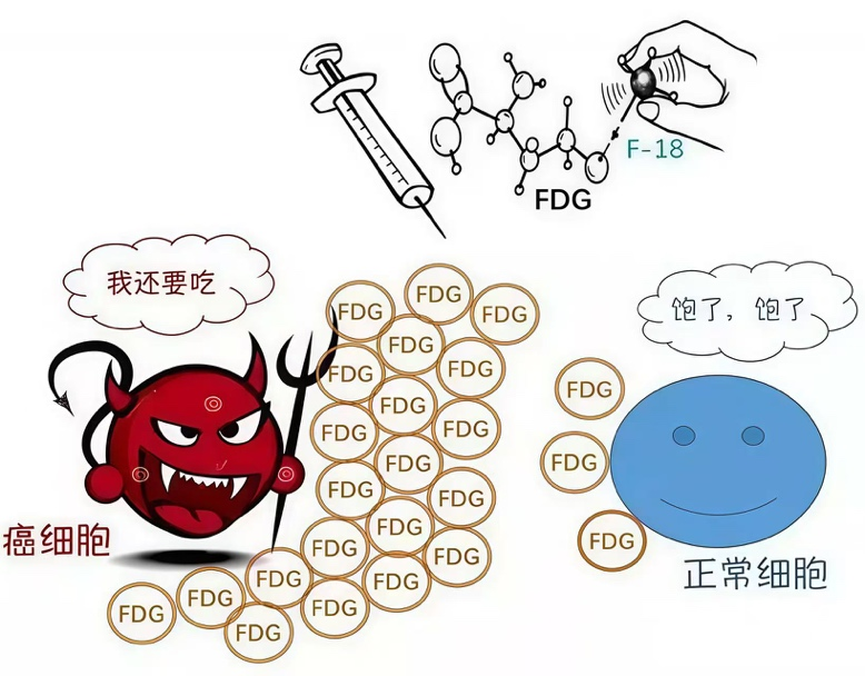 新技术 | 核医学科开展神经内分泌肿瘤双核素显像