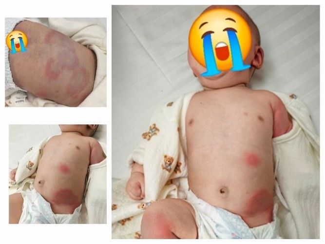 二月龄宝宝突发重症，儿童呼吸与重症医学科团队筑防线