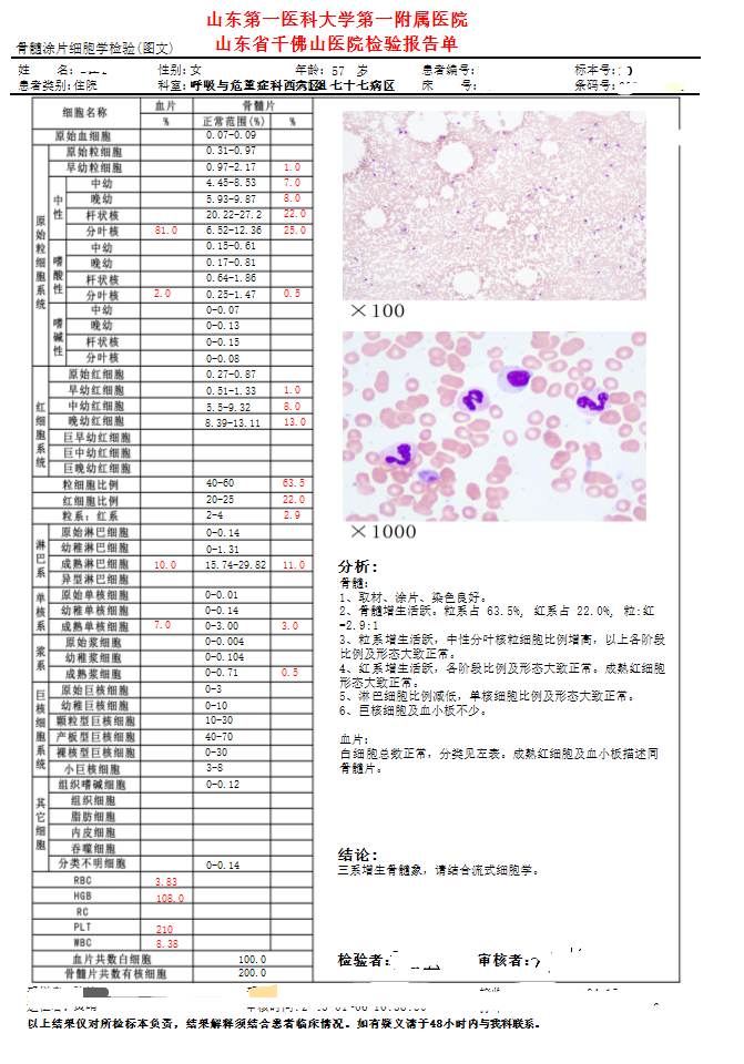 Castleman病的规范化治疗