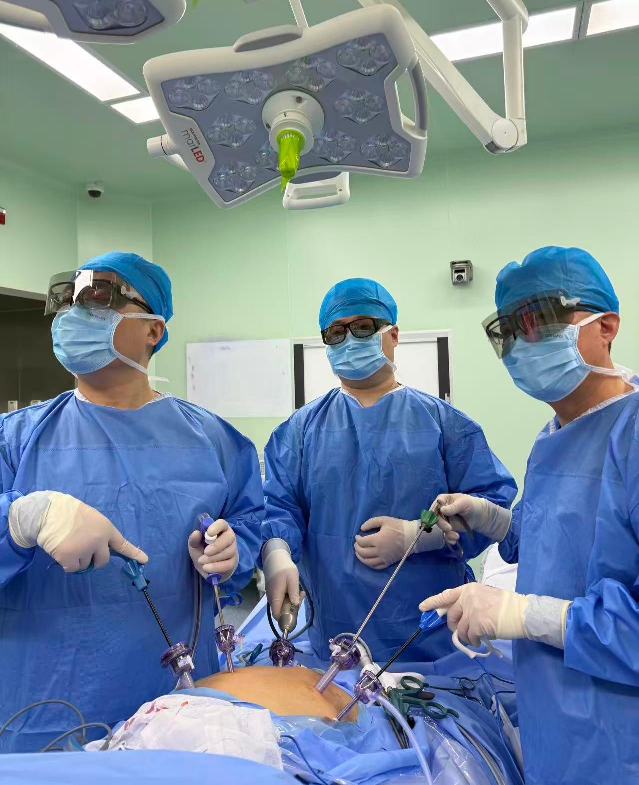 医院完成一例腹腔镜下巨大肝血管瘤切除术